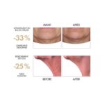 [Original] Vichy Laboratories Neovadiol Phytosculpt Neck & Face Contours, 50mL - view 3