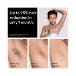 Braun Smart IPL, Skin i·Expert Pro 7: at Home Laser Hair Removal, Model: 6036 (Brand New) - view 7