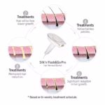 Silk'n Flash & Go Pro IPL hair removal device treatment cycle results